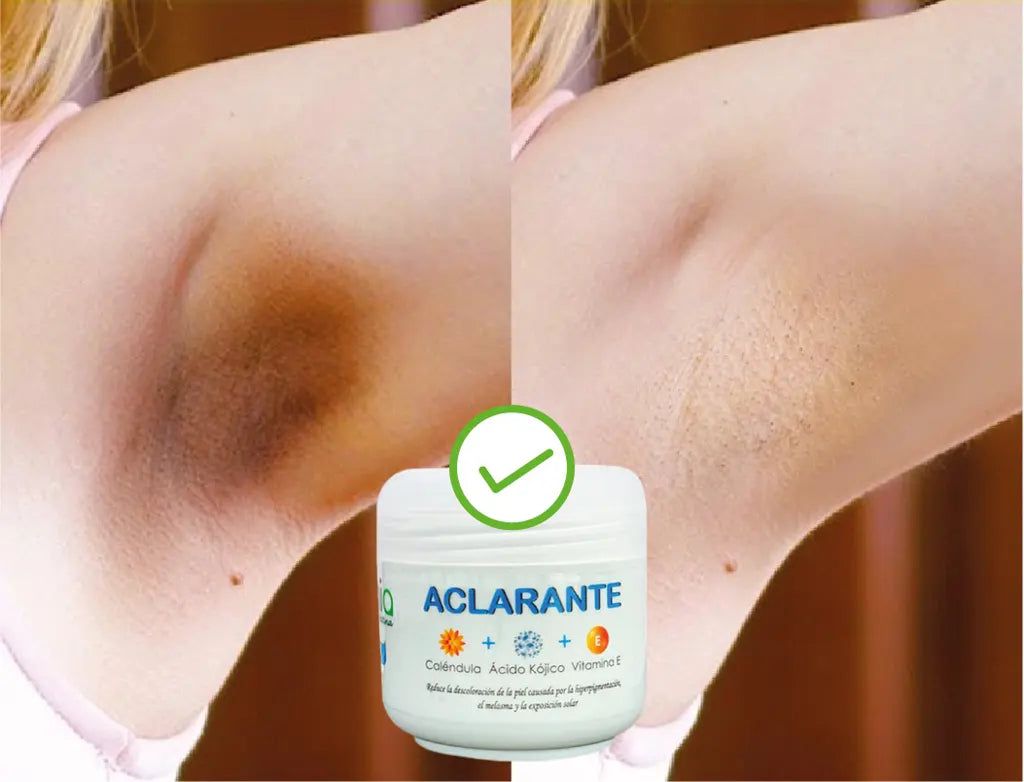 ✨ Crema Aclarante 2x1: ¡Ilumina tu Piel! ✨